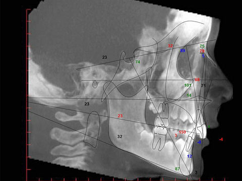 NewTom<br>高解析3D電腦斷層掃描